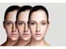 remove wrinkle dark spots