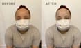 do replacement of skin color
