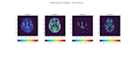 analyze your biomedical data in matlab r python