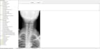 analyze and edit your dicom files