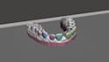trim and prepare dental 3d models