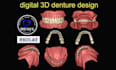 design high quality dentures using exocad