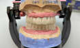 create dental artistry with exocad 3d