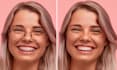 remove braces, glasses, or anything else