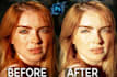 quickly remove pimples marks and dark spots, acne, from face