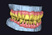 provide you excellent dental prothetic designs using exocad