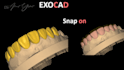 design snap on smile