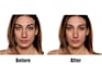 retouch pimples, wrinkles, blackheads and make your skin look smoother