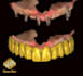 design a custom implant crown for your digital dental case