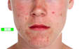 cprofessionally smooth spotty photos