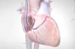 create 3d medical animation, medical video, surgery
