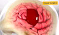 create aesthetic 3d medical animation, medical video with super quality