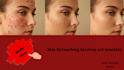 retouch your skin, remove your pimples and acne in photoshop