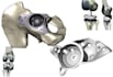 create personalized orthopedic implants