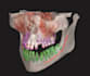 convert medical images to medical 3d model