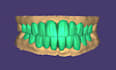 do expert dental design on exocad crowns, bridges and more
