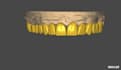 design anatomical mono, cutback and implant teeths