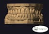 do master crafted dental design for smiledesign and waxups