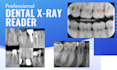read your dental x rays