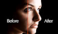 remove acne and blemishes from photos
