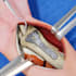 do 3d medical animation video super fast