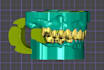design digital dental models