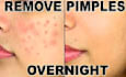 do remove pimple and enhance photo quality