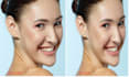 do skin smoothing, remove acne and blemishes