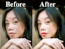 remove pimple and spot from face and body