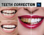 edit your teeth whiten, align and fix ,remove braces using photoshop