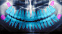 annotate radiology, x ray, ct and mri images