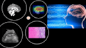 medical image analysis with machine learning, deep learning