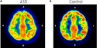 machine learning medical image analysis