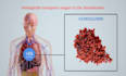 create realistic 3d medical animation, medical animation, surgery animation