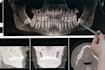 review dental x rays and radiographs