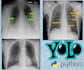 do medical imaging disease diagnosis in machine learning python
