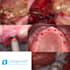 create dental implant planning and digital surgical guides using codiagnostix