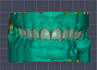 design full anatomic crowns