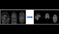 preprocess your mri images