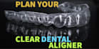 plan your clear dental aligners treatment