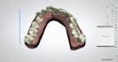 do dental clear aligner treatment planning on onyxceph, hit and 3shape analyzer