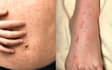 help you solve your skin problem being a dermatologist