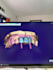 3d dental designing, full anatomic crowns