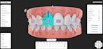 provide dental clear aligners treatment planning services