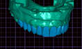 make your cad dental design with high quality