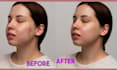 do professional high end skin retouching