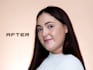 skin retouch your photos