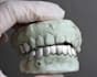 create realistic 3d teeth grillz, cad files for gold silver and diamond grillz