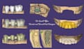 design crown, bridges, smile, veneer  dental cad using exocad
