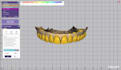 do digital smile design 3d and 2d mockup using exocad